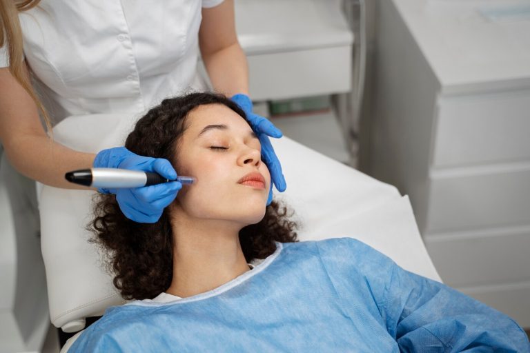 microneedling